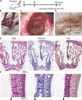 Squamous and Respiratory Metaplasia After Olfactory Mucosal Resection